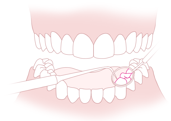 tooth11