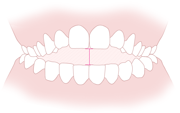 tooth8