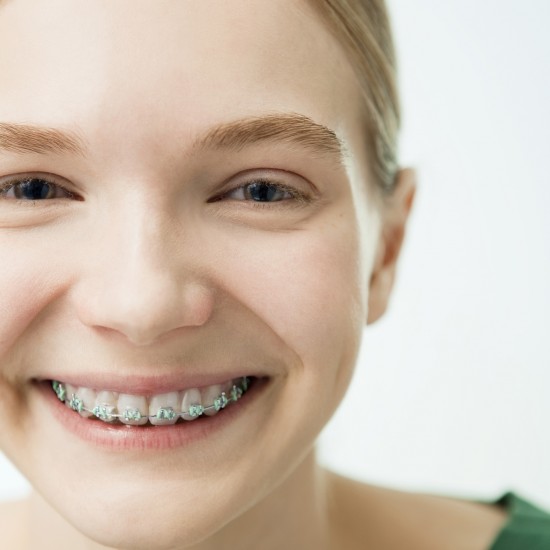 The portrait of smiling girl with dental braces.