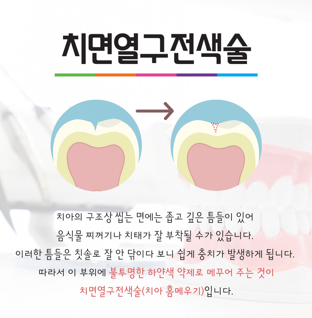 과잉치-페북