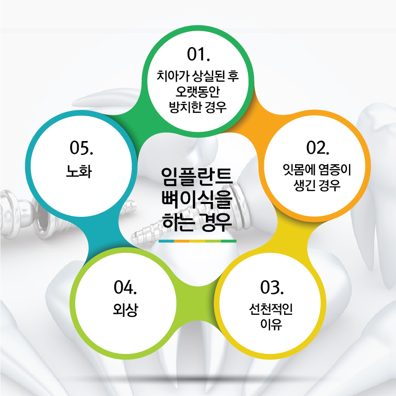 [울산임플란트] 임플란트 뼈 이식 제대로 알고 받자!!울산치과 한빛치과병원 | 울산치과 한빛치과병원